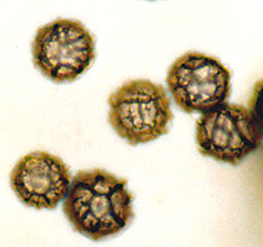 Gastrolactarius sp.