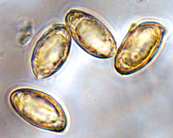 Brauniellula albipes 