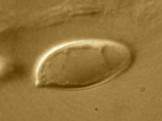 Brauniellula nancyae