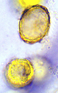 Cazia flexiascus 