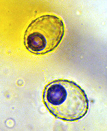 Cazia flexiascus 