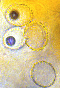 Cazia flexiascus 