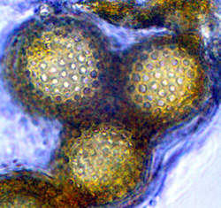 Choiromyces alveolatus