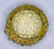 Choiromyces alveolatus