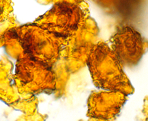 Chondrogaster pachysporus 