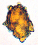 Chondrogaster pachysporus 
