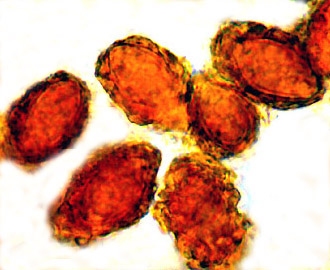 Chondrogaster pachysporus 