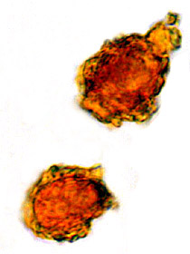 Chondrogaster pachysporus 
