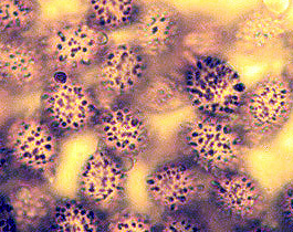 Cystangium medlockii