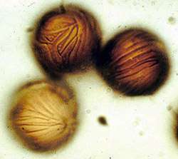 Elaphomyces virgatosporus