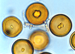 Elaphomyces granulatus