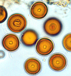 Elaphomyces granulatus