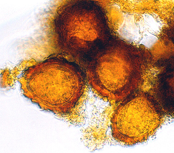 Fischerula subcaulis