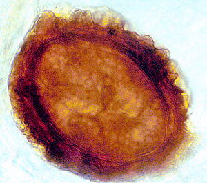 Fischerula subcaulis