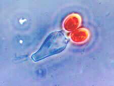 Gastrocybe sp. 