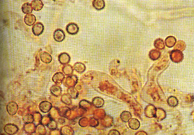Gastrosporium simplex