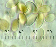 Gastrosuillus sp.
