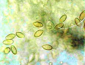 Gastrosuillus amaranthii