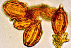 Gautieria sp.