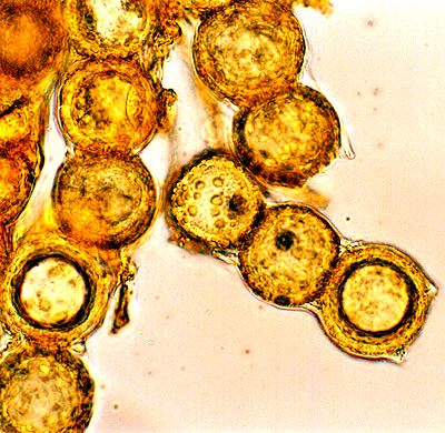 Genabea cerebriformis