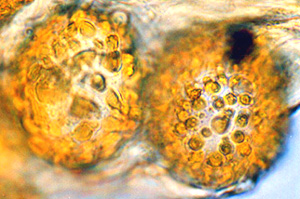Genea gardneri 