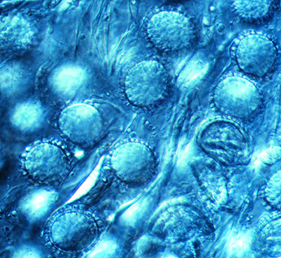 Genea harknessii