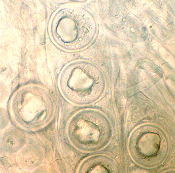 Genea intermedia