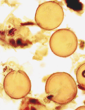 Glomus convolutum