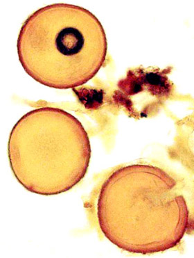Glomus convolutum