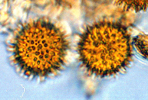 Gymnomyces rogersii