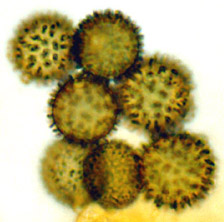 Gymnomyces socialis