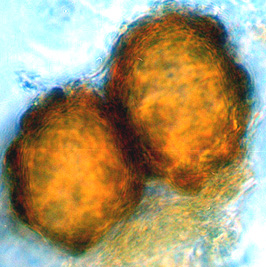 Hydnotrya cerebriformis