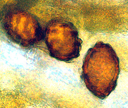 Hydnotrya cerebriformis