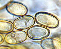 Hydnotryopsis sp.