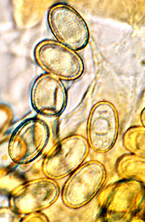Hydnotryopsis sp.