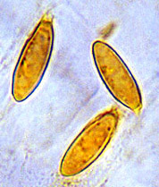Hysterangium crassirhachis