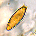 Hysterangium setchellii