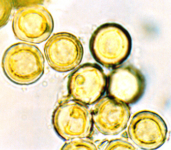 Leucophleps spinispora