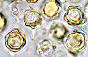 Leucogaster gelatinosus
