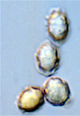 Leucogaster microsporus