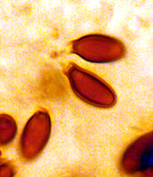 Melanogaster broomeanus