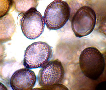 Mycolevis siccigleba