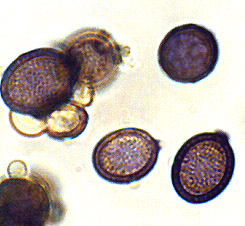 Mycolevis siccigleba