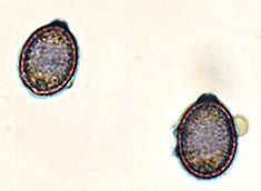 Mycolevis siccigleba