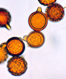 Neosecotium macrosporum