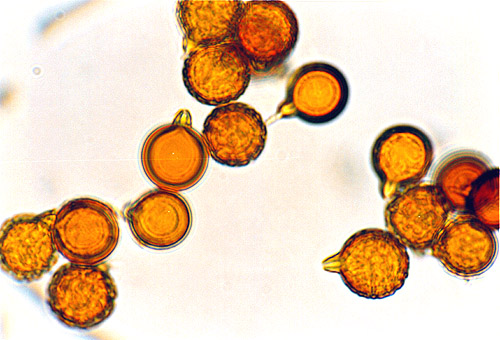 Neosecotium macrosporum