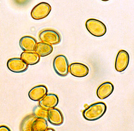 Nivatogastrium wrightii