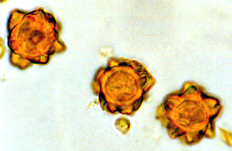 Octaviania purpurea