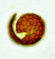 Paradaoxa monospora