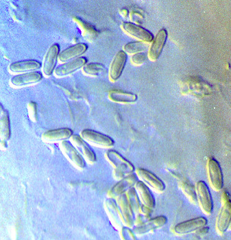 Phallogaster saccatus